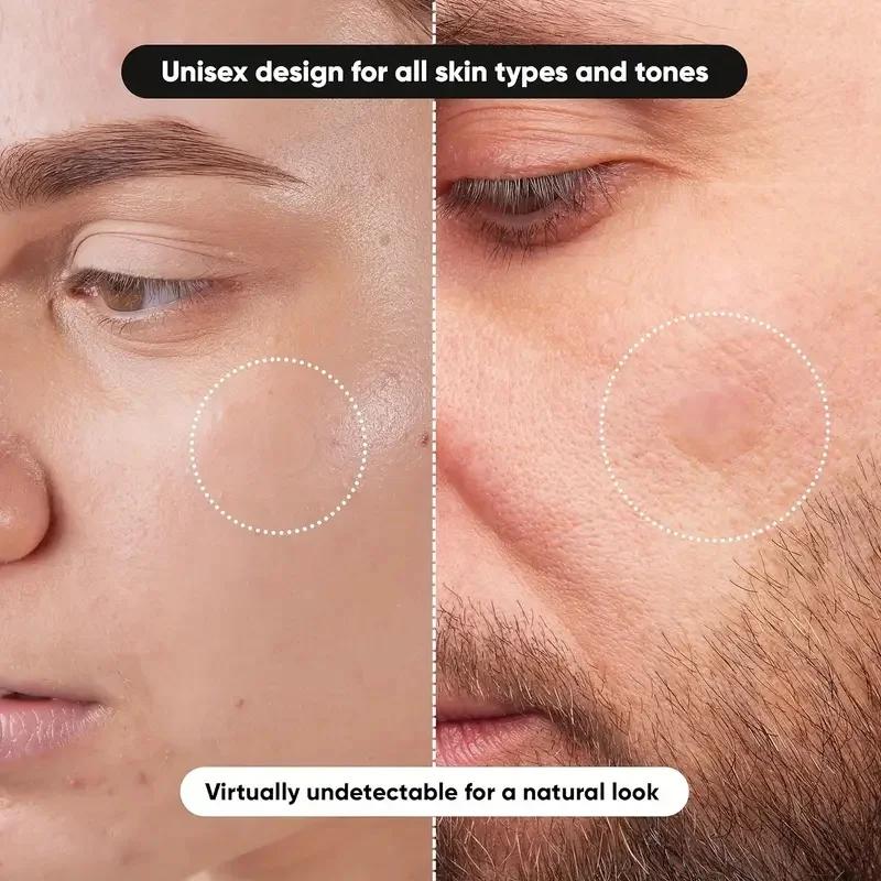 360 pieces/box acne patches -  - Face Oil review and price